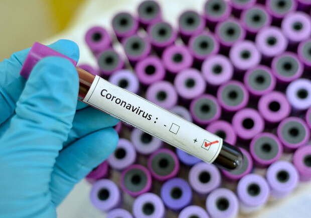 Сидим дома: в Запорожской области подтвердили 2 случая коронавируса фото