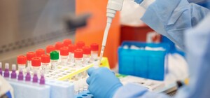 У першу чергу: кого з львів'ян перевірятимуть на COVID-19