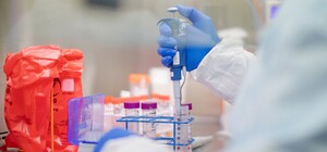 На сегодняшний день в Полтавской области зафиксировали 20 заболевших на COVID-19: новый случай в Кременчуге