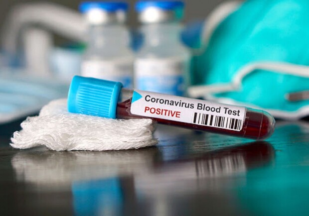 Сколько заболевших коронавирусом в Запорожье 11-го июля/ фото: pinterest