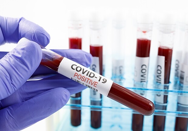 В Запорожье в лабцентре не будут проводить платные тесты на коронавирус / фото: healthtimes.com.au