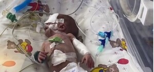 Совсем крошки: в перинатальном центре преждевременно родилась двойня