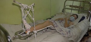 Скандал в школе под Одессой: ребенка со сломанной ногой вынесли из учреждения