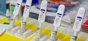 День борьбы со СПИДом: где в Киеве можно сделать бесплатный тест на ВИЧ