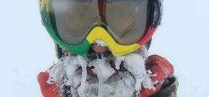 Можуть ампутувати ноги: лікарі розповіли про здоров'я 25-річного львів'янина, який заблукав у горах