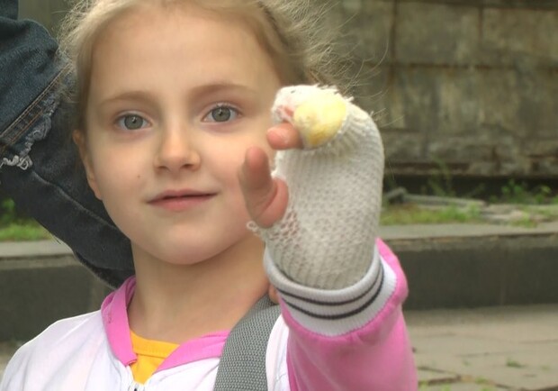 Стало известно о состоянии 6-летней девочки, которую гадюка укусила за пальчик. Фото: "Суспільне"