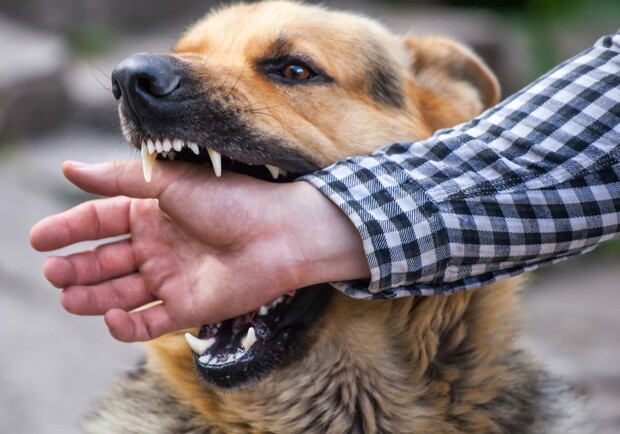 Попала в больницу: в Запорожье девушку покусал домашний пес. Фото: Getty Images