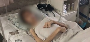 Гематомы и странное масло: отец, моривший голодом 16-летнего одессита, рассказал о порче