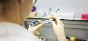 В Одессе обнаружили штамм 