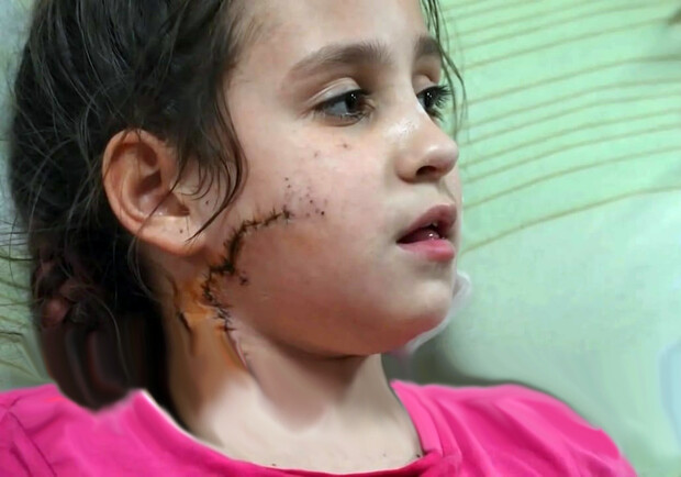 На блокпості на Запоріжжі окупант вистрілив в обличчя 11-річній дівчинці. 