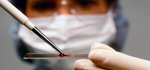 В Одесі можна буде безкоштовно скласти тест на ВІЛ та гепатити