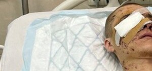 Обломки пробили глаз и повредили череп: в Днепре спасают бойца, получившего тяжелые ранения