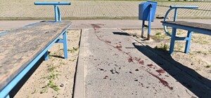 Количество пострадавших от удара по школьному стадиону в Харькове выросло (фото)