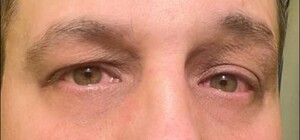 Нападение на военного в Одессе: комментарий ТЦК