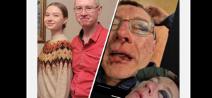 Жестокое задержание в парке Киева: отец получил перелом глазницы и кровоизлияние в мозг