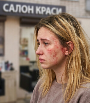 Испортили волосы или сожгли кожу в салоне: адвокат объяснила, как получить компенсацию