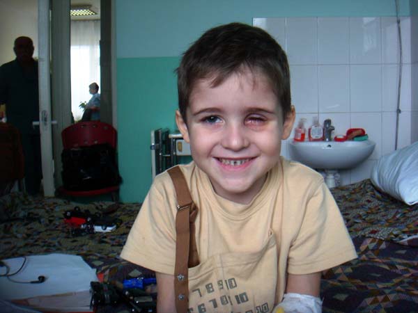 Саше Слепцову удалили один глаз - родители борются за сохранение второго