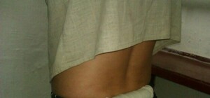 У запорожского зэка достали из широких штанин...упаковку наркотиков