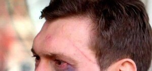 Завтра в Одессу приедут сразу два кандитата в президенты: избитый Царев и изгнанный Тигипко