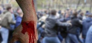 Точку в деле самообороны и УБЭПа поставит Президент