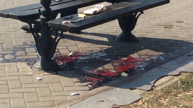 Новость - События - ШОК: В центре города мужчине перерезали горло. Фото с места убийства