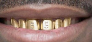 Львівські поліціянти знайшли барсетку з золотими зубами