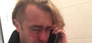 Драма дня: в Киеве Игоря Мирошниченко избил любовник жены