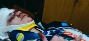 Терміново: львів’ян просять  здати кров для хлопця, що постраждав в ДТП