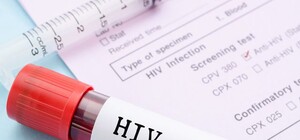 Безкоштовно та анонімно: сьогодні у Львові можна зробити експрес-тест на ВІЛ