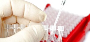 Безкоштовно та анонімно: коли і де у Львові можна зробити експрес-тест на ВІЛ