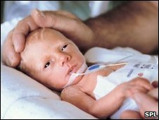 Новорожденный весит меньше 2 килограмм.
Фото newsimg.bbc.co.uk.