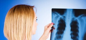 ЧП: под Одессой с больным туберкулезом педиатром контактировали 600 детей