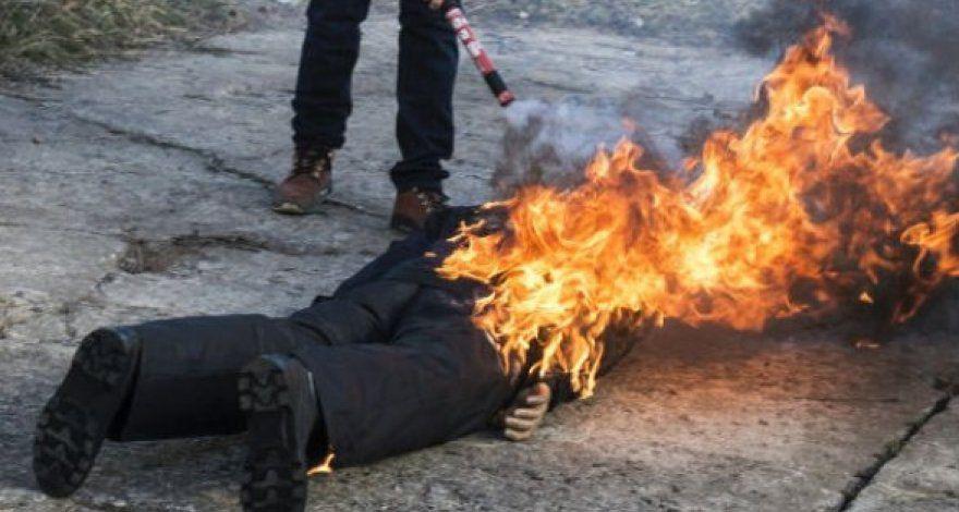 На Кичкасе мужчина поджег себя. Фото: мedia.аz