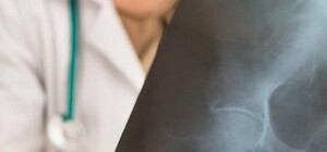 Где в октябре в Киеве можно бесплатно пройти флюорографию. Адреса