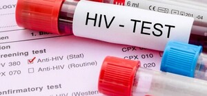 Бесплатно и анонимно: киевлян зовут провериться на ВИЧ. Адреса