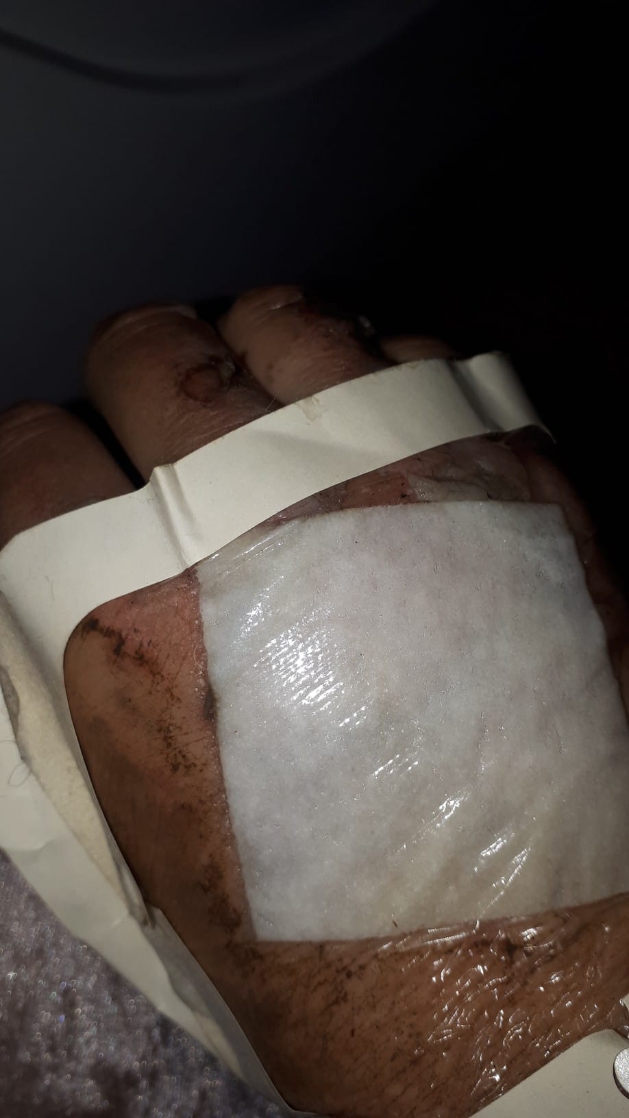 Пострадала волонтер.