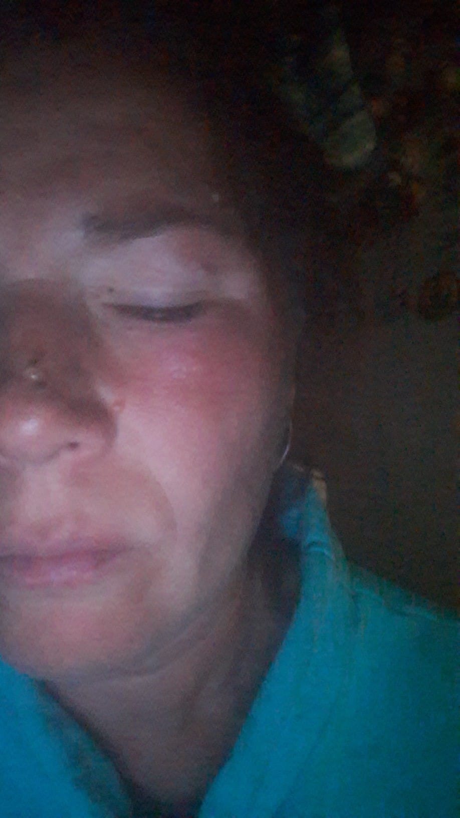 Пострадала волонтер.