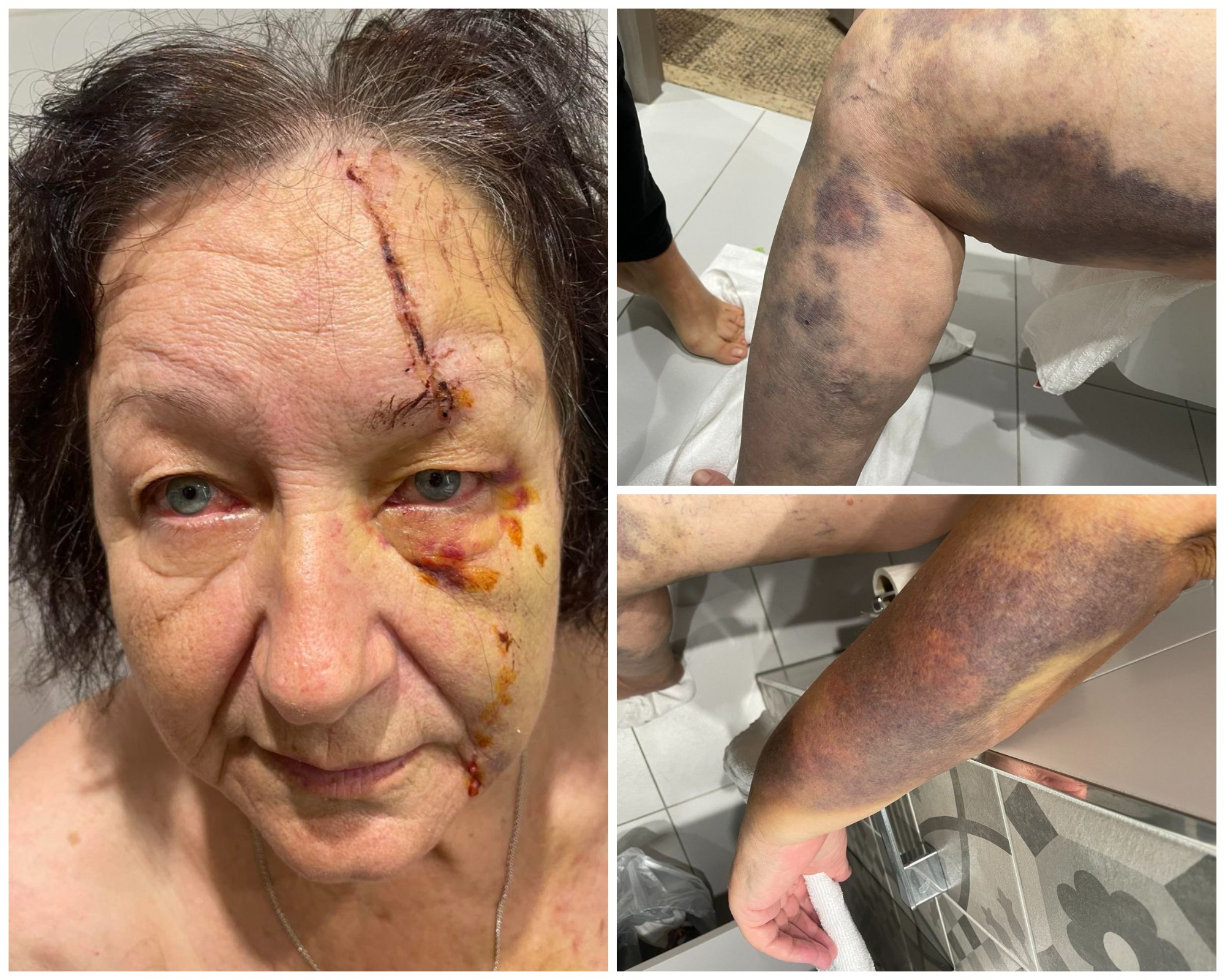 Постраждала в результаті ракетного удару по Запоріжжю - фото надіслала сама Світлана