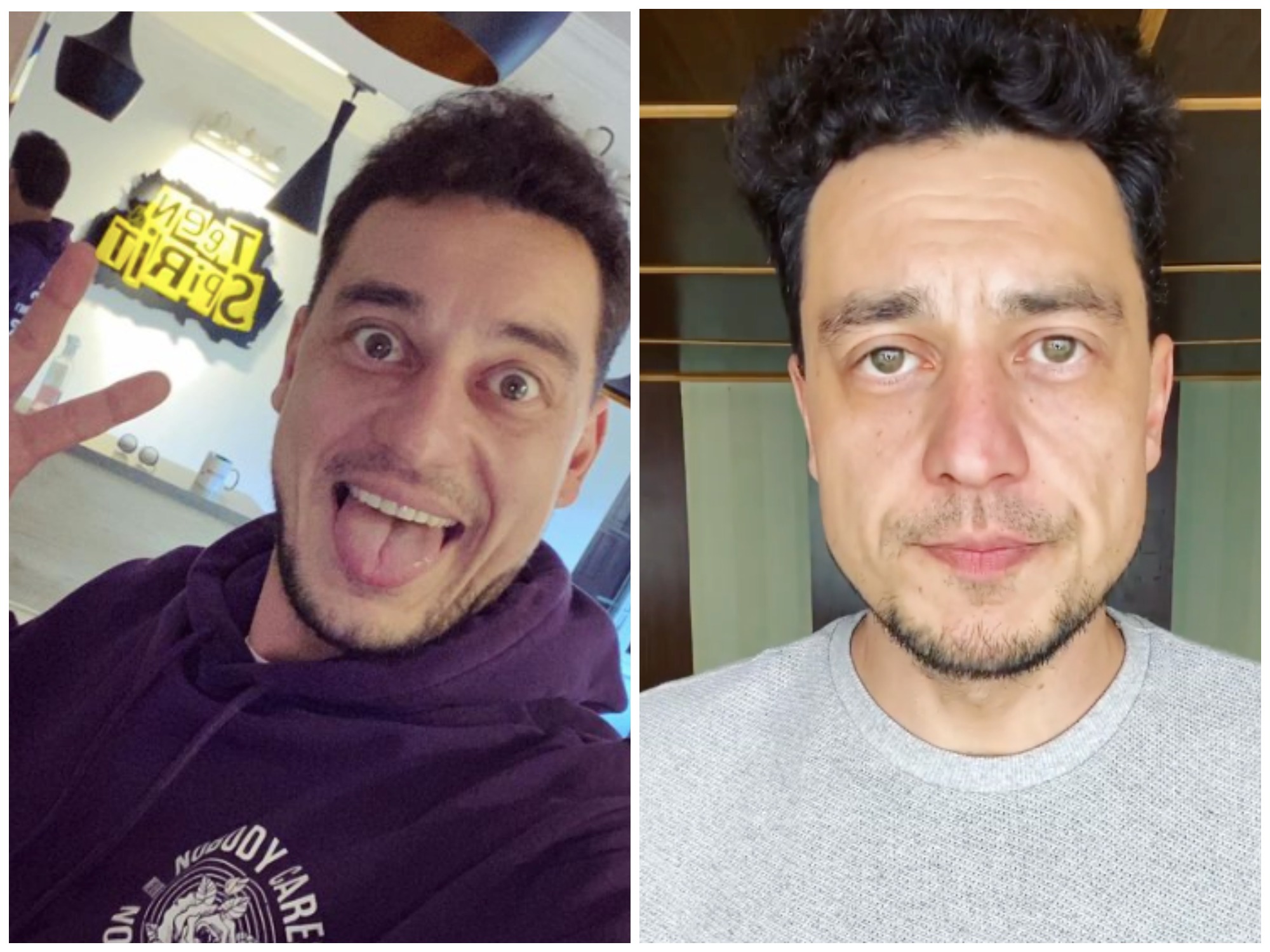 Как изменился Женя Синельников из Запорожья з время полномасштабной войны -