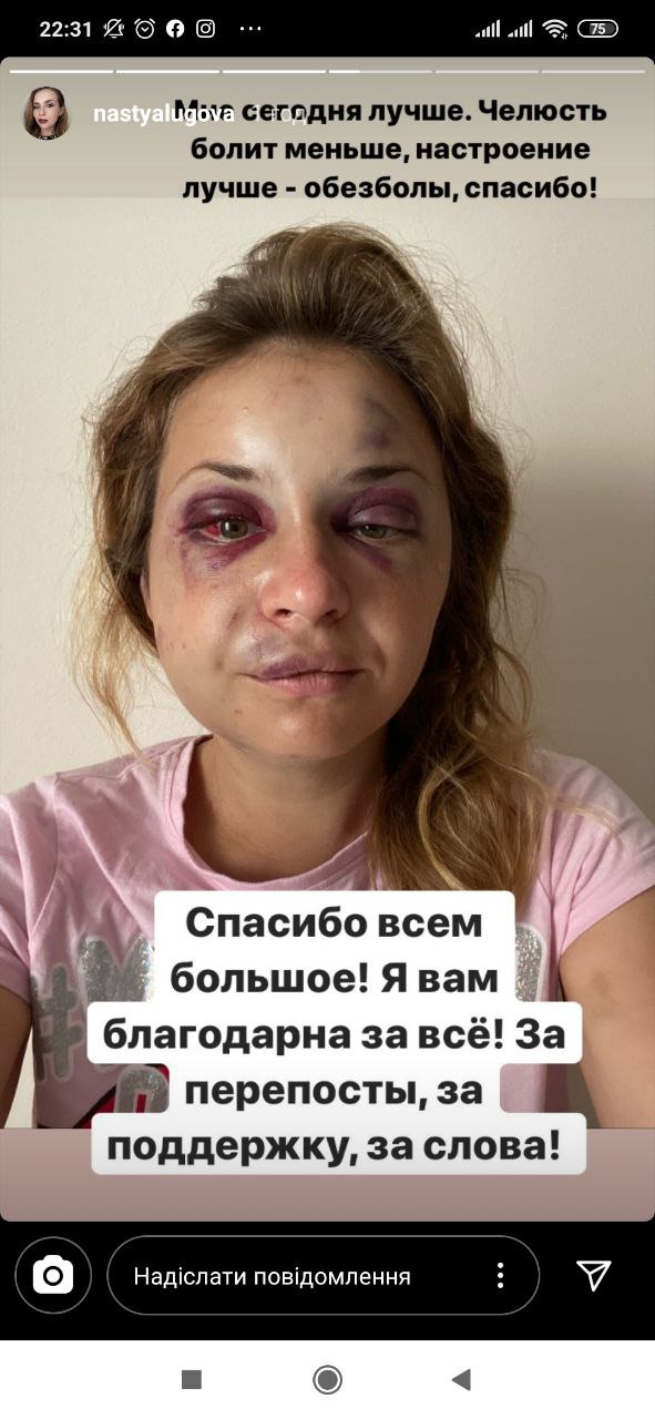 Так Анастасия выглядит сегодня / фото с ее странички в Инстаграм