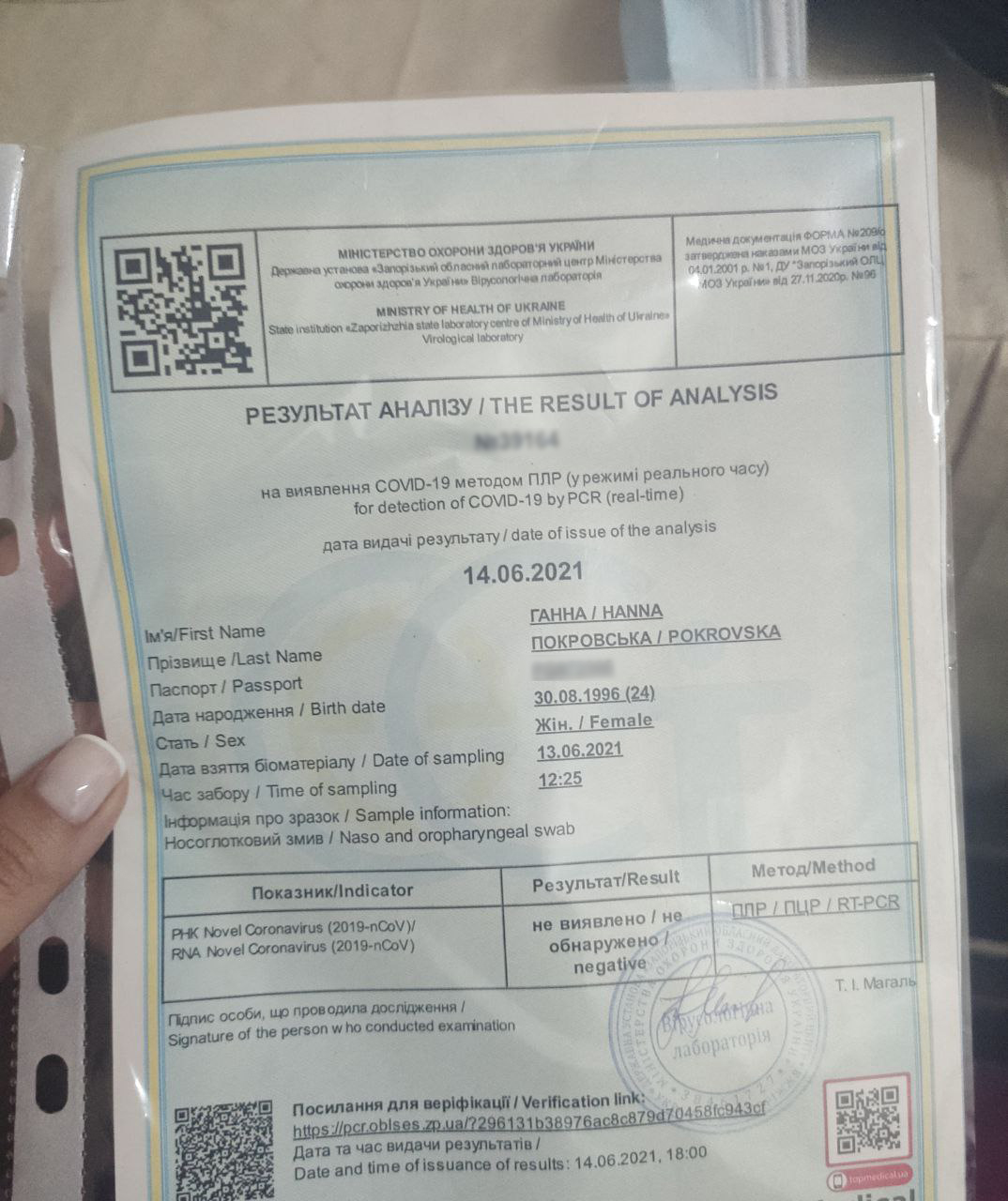 Пример результата ПЦР-теста международного образца / фото: VGorode