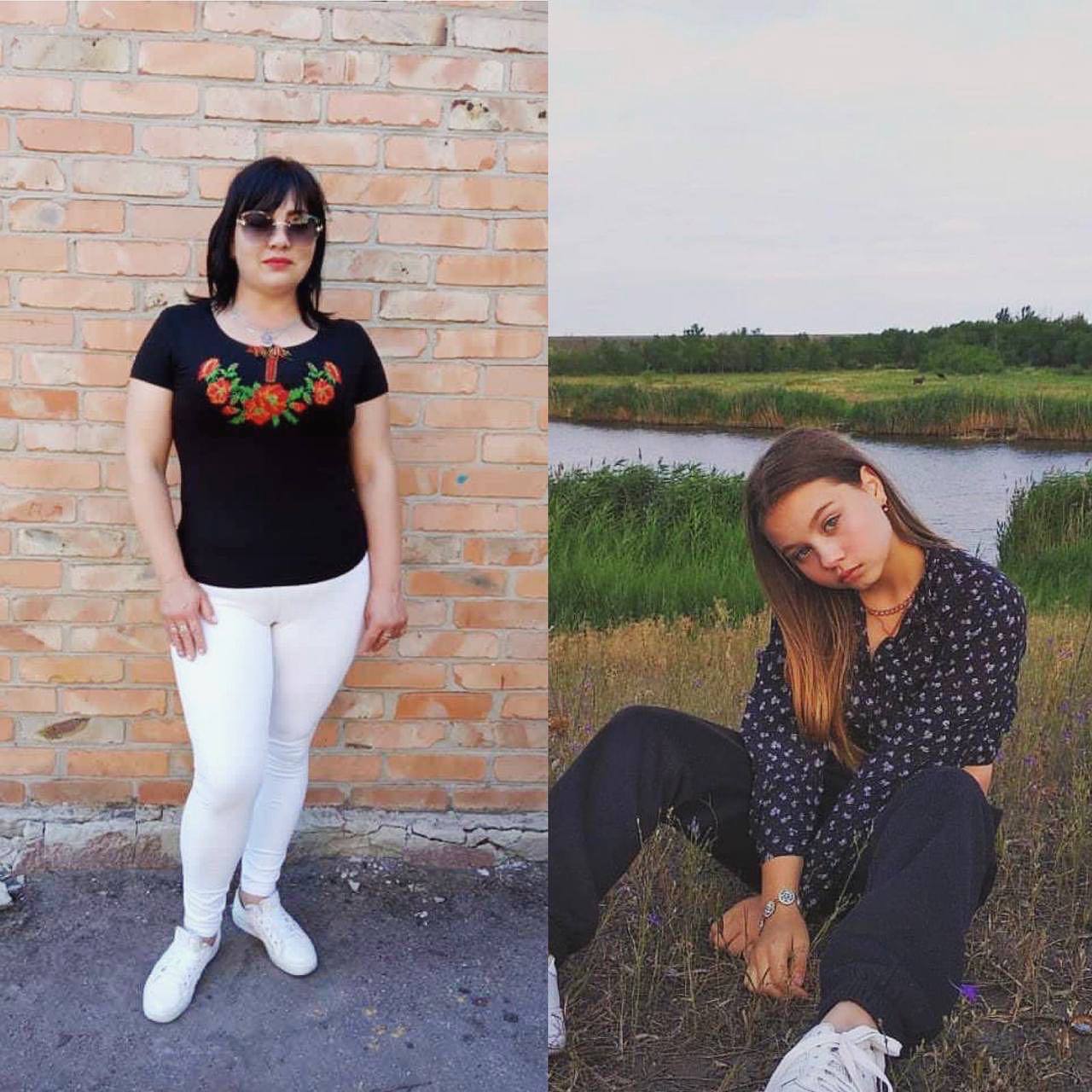 В Запорожской области мама с дочкой остались без ног из-за обстрела российских оккупантов -