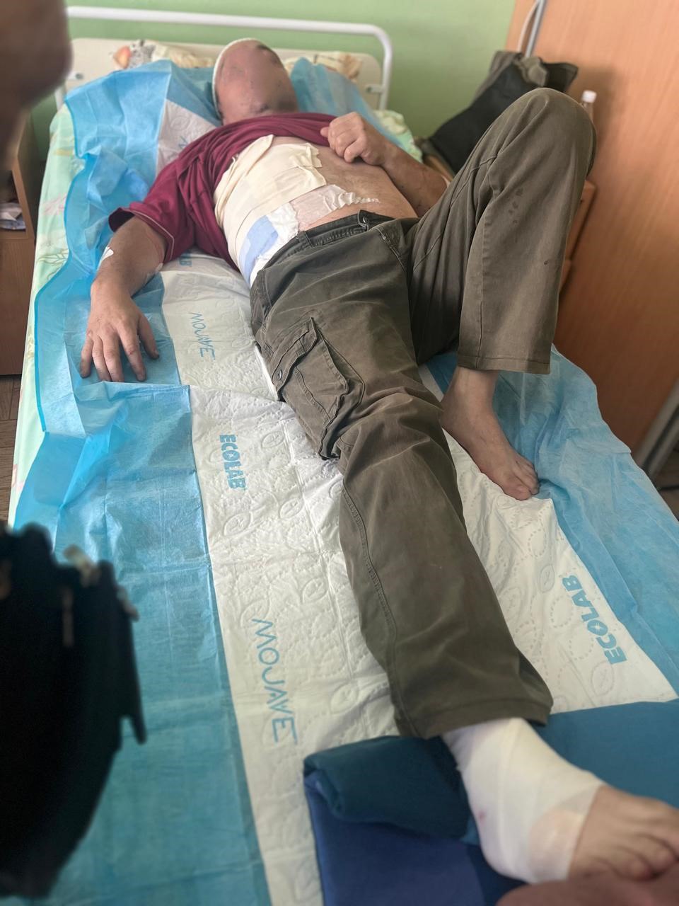 на фото лицо пострадавшего энергетика скрыто из соображений безопасности.