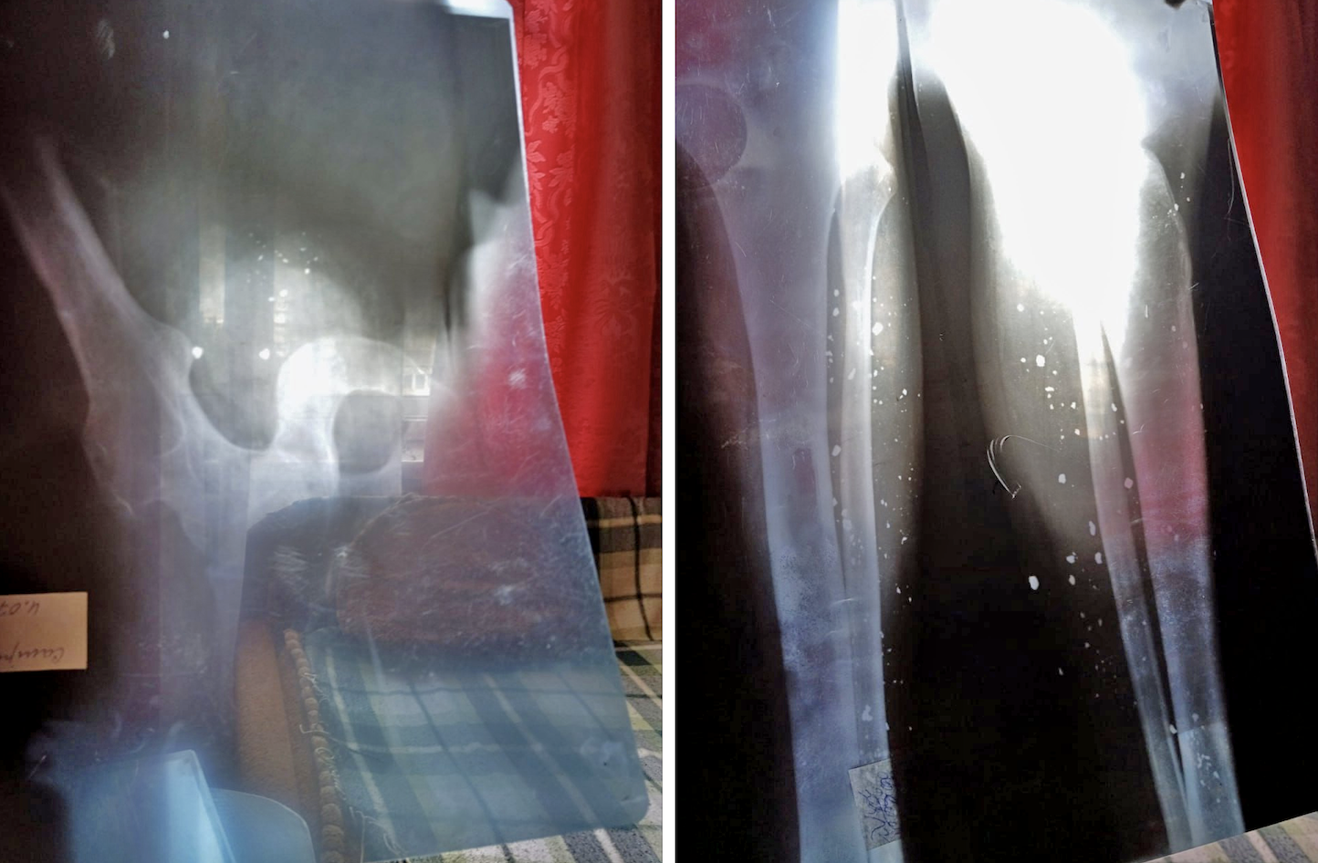 Белые пятнышки – это обломки - фото предоставила мама Юрия