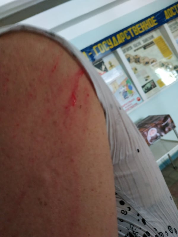 Пассажирка расцарапала руку водителю троллейбуса. Фото: "Акцент"