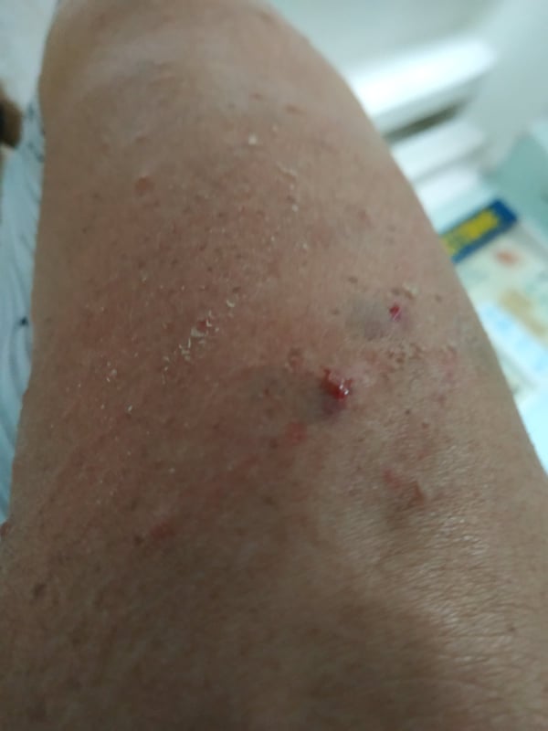 У водительницы троллейбуса ссадины, синяки и царапины. Фото: "Акцент"