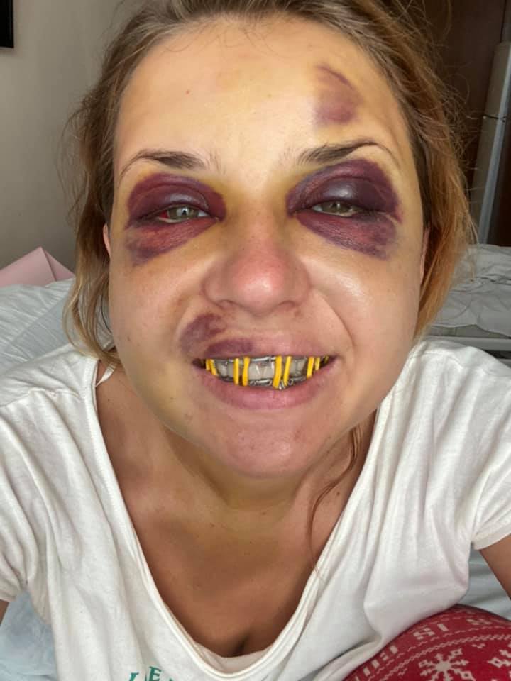 Вот так Настя выглядит 4 августа. Фото: fb Анастасия Лугова