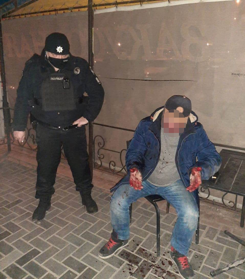 В центре задержали мужчину, который выстрелил в посетителя кафе. Фото: Полиция охраны в Запорожской области