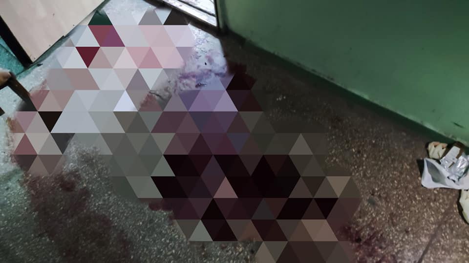 В Запоріжжі вибухнув трофейний боєприпас: постраждав місцевий активіст.