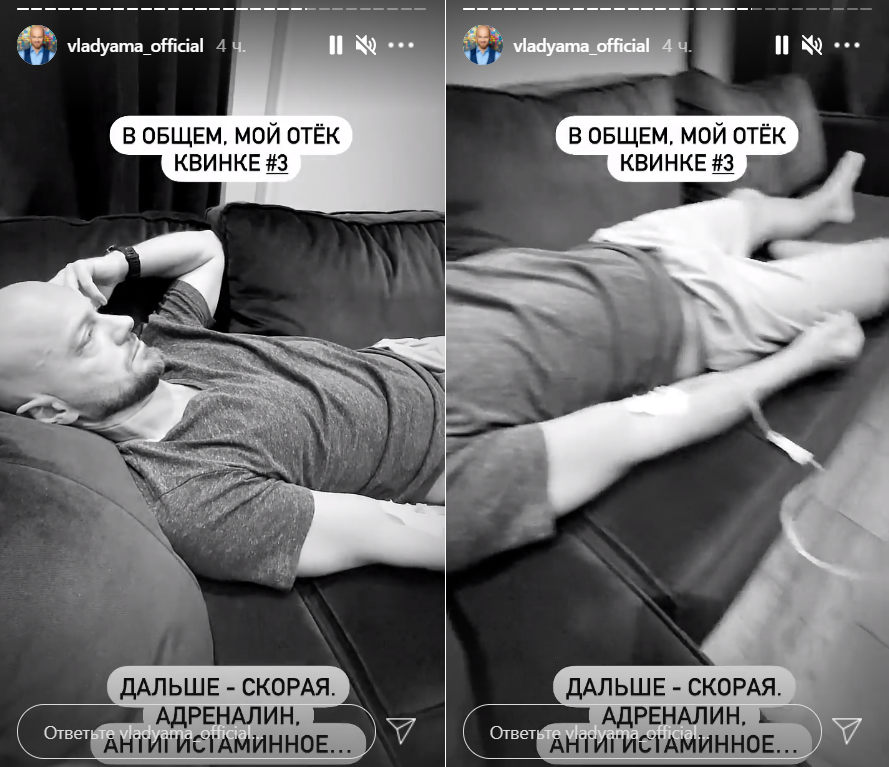 Приехавшая "скорая" вколола артисту антигистаминное. Фото со странички Влада Ямы